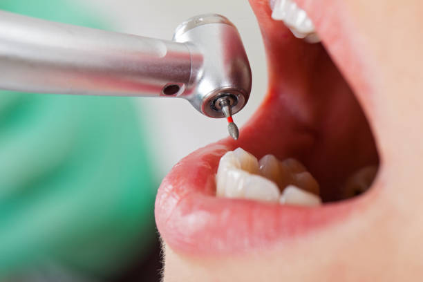 Best Emergency Broken Tooth Repair in Grafton, WI